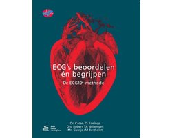 ECG's - beoordelen én begrijpen