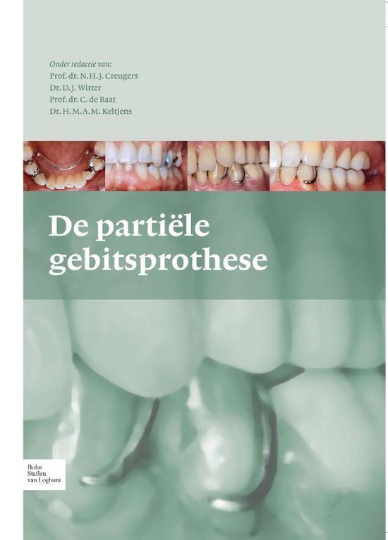 De partiele gebitsprothese - cover