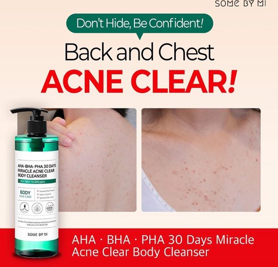 SOME BY MI - AHA BHA PHA 30 Days Miracle Acne Clear Body Cleanser | Rug Acne | Body wash voor puisten - SOME BY MI