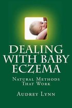 Dealing with Baby Eczema