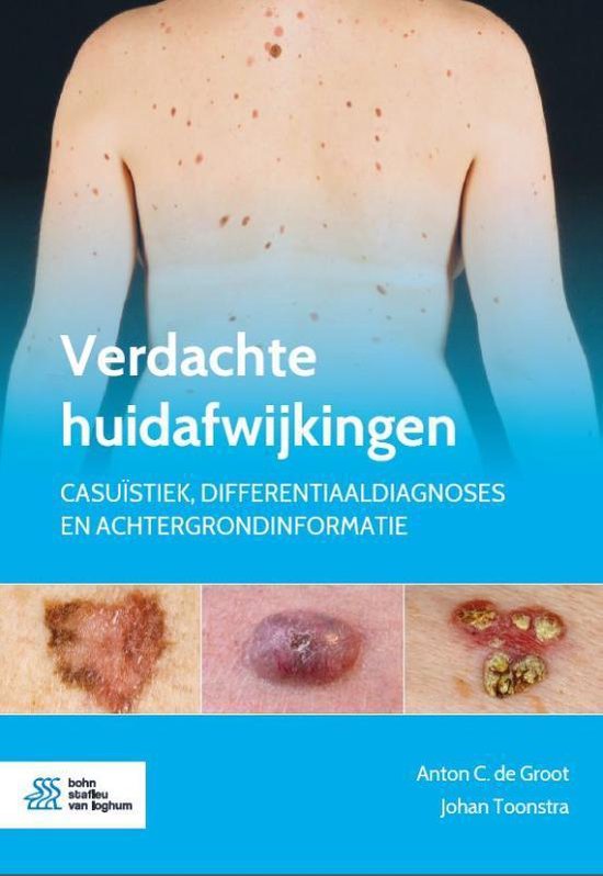 Verdachte huidafwijkingen - cover