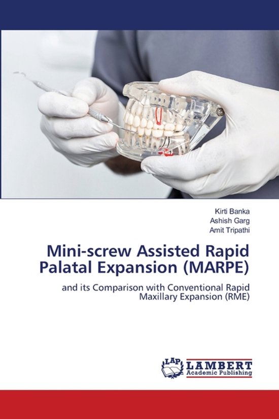 Boek 'Mini-screw Assisted Rapid Palatal Expansion (MARPE)' met een afbeelding van een tandarts die een kunstgebit demonstreert.