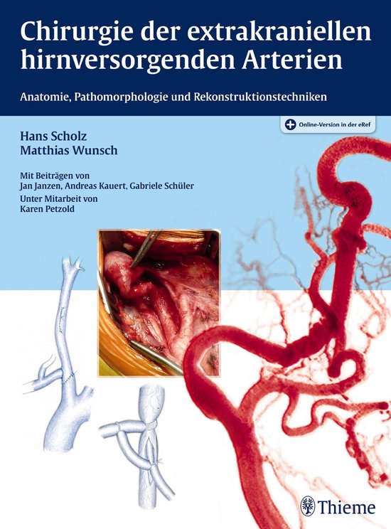 Chirurgie der extrakraniellen hirnversorgenden Arterien - cover