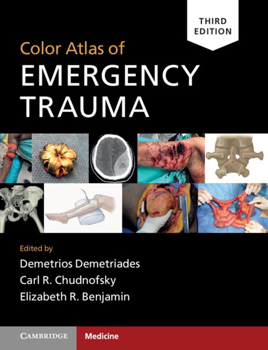 Color Atlas of Emergency Trauma - cover