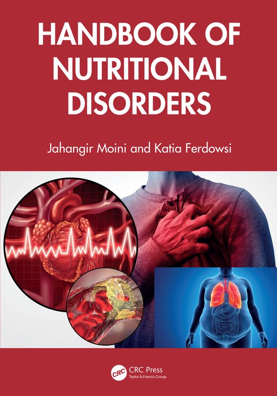 Handbook of Nutritional Disorders - cover
