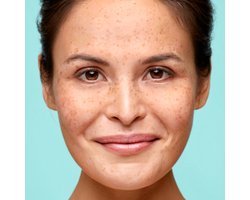 Biodermal Nachtcrème Gevoelige Huid - 2 x 50 ml - Voordeelverpakking