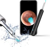 Veilige oorreiniger WIFI oorcamera 2021 | LED-licht, 360 ° groothoek FHD | Otoscoop | Android - IOS | Oorsmeer | inspectiecamera