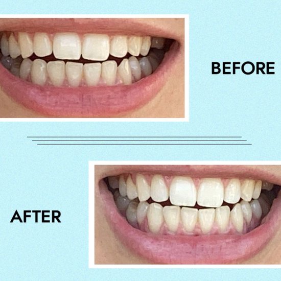 HiSmile Purple Teeth Whitening Toothpaste bol