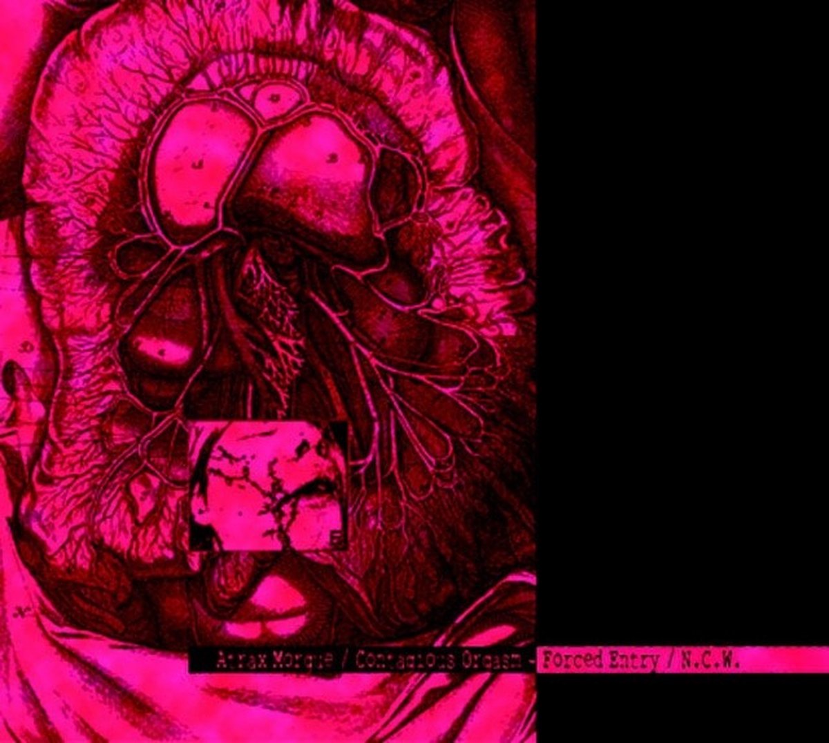 Atrax Morgue & Contagious Orgasm - Forced Enrty/N.C.W. (CD)