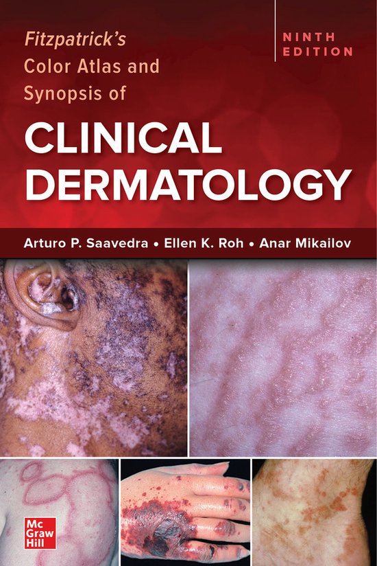 Fitzpatrick's Color Atlas and Synopsis of Clinical Dermatolo ... - cover