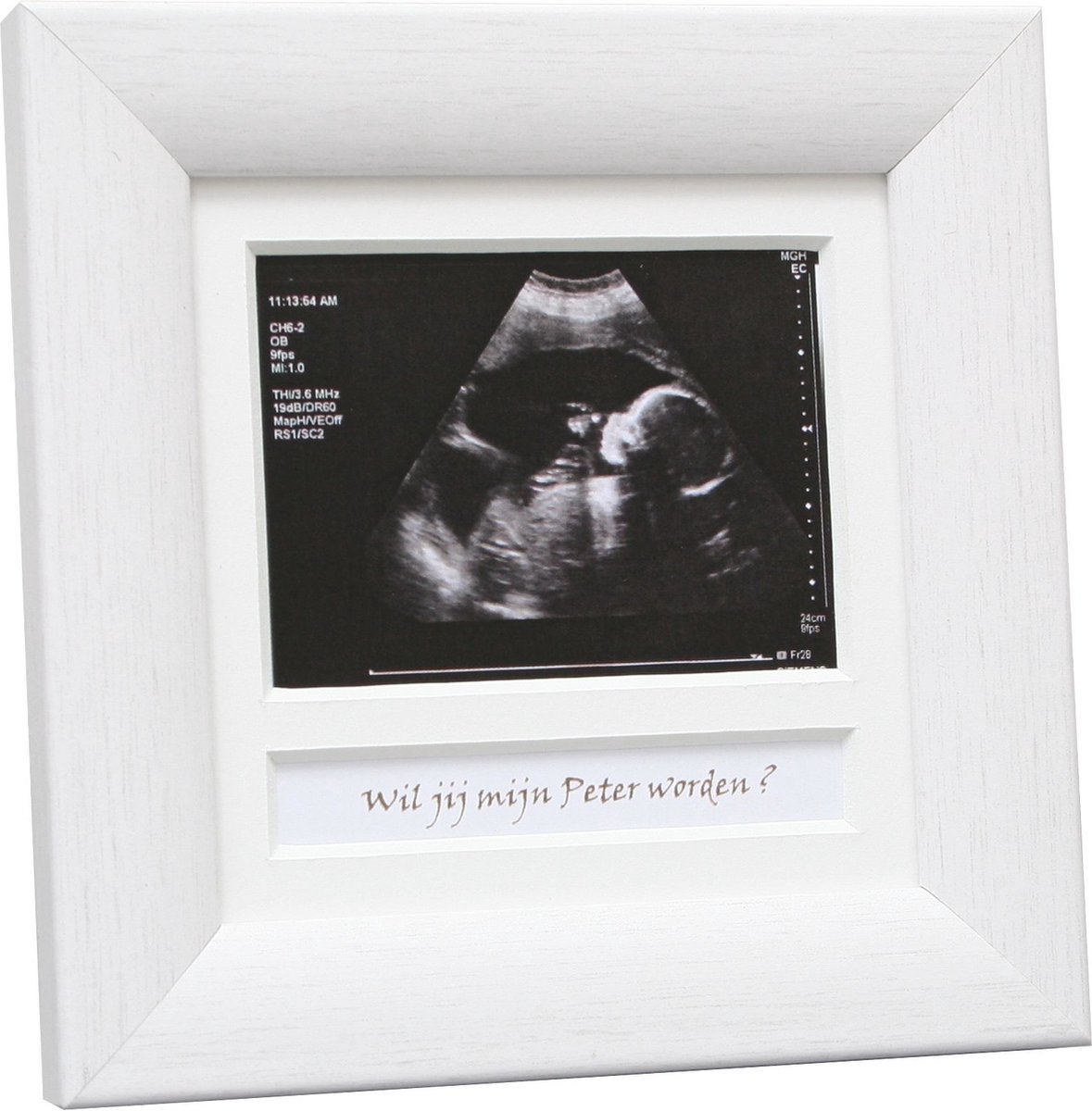 Cadre photo en bois Deknudt pour échographie de grossesse