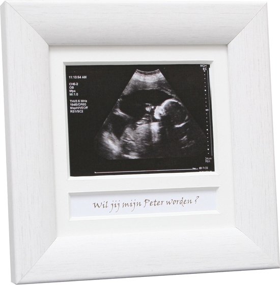 Cadre d'échographie, cadre photo d'annonce de bébé, cadeau de