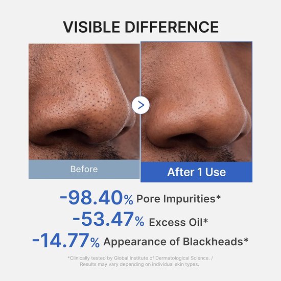 Medicube Zero Pore Blackhead Mud Mask Original 100g - Korean Skincare - Alle huidtypes - Acne - Poriën - Huidverzorging - Glass Skin — cadeau in Verzorging - foto 3