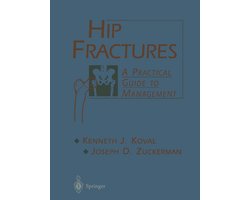 Hip Fractures