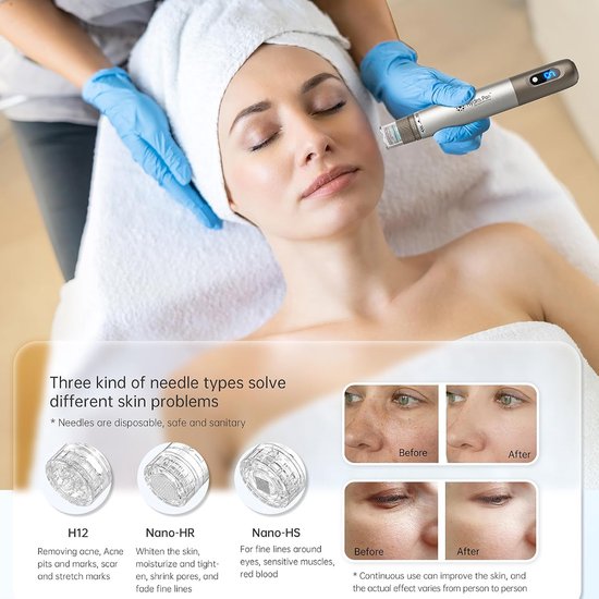 10 reservepatronen voor Microneedling Nano-HR, reservenaalden voor serumapplicator Hydra Pen H3, echte wegwerp-reservepunten, huidverzorgingsaccessoires — afbeelding 3