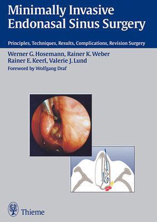 Minimally Invasive Endonasal Sinus Surgery - cover