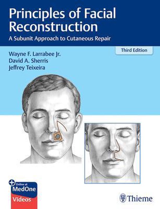 Principles of Facial Reconstruction - cover
