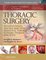 Thoracic Surgery Lung Transplantation