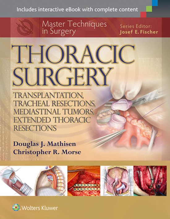 Master Techniques in Surgery: Thoracic Surgery