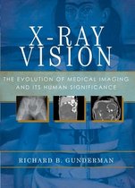 X-Ray Vision