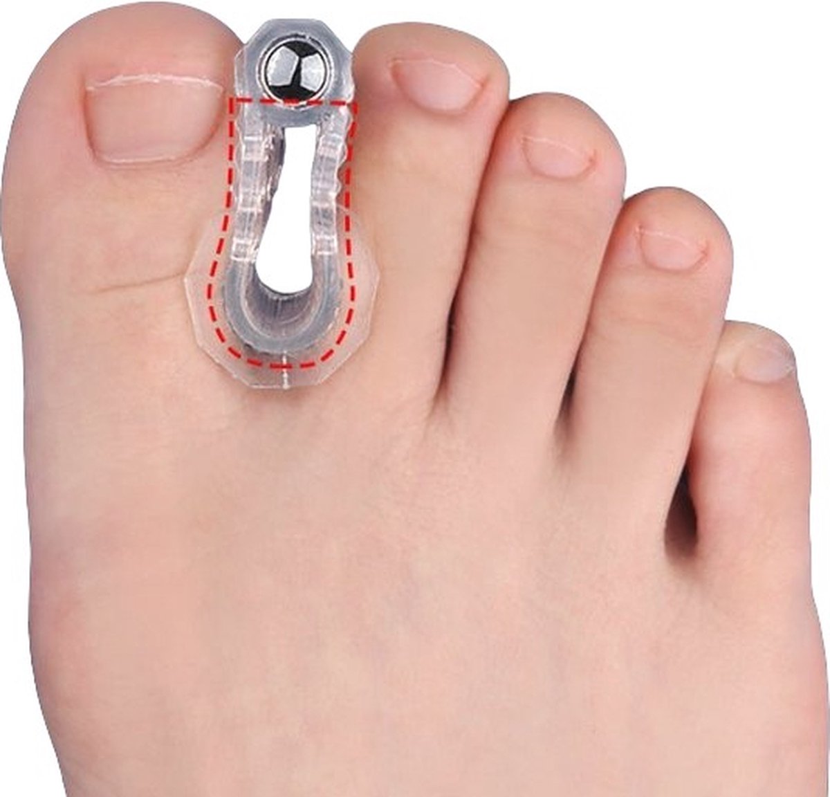 Goedkoopste Hiden - Teenspreider - Teenspreider Siliconen - Teen corrector - Teenspreider voor alle tenen - Hamer teen