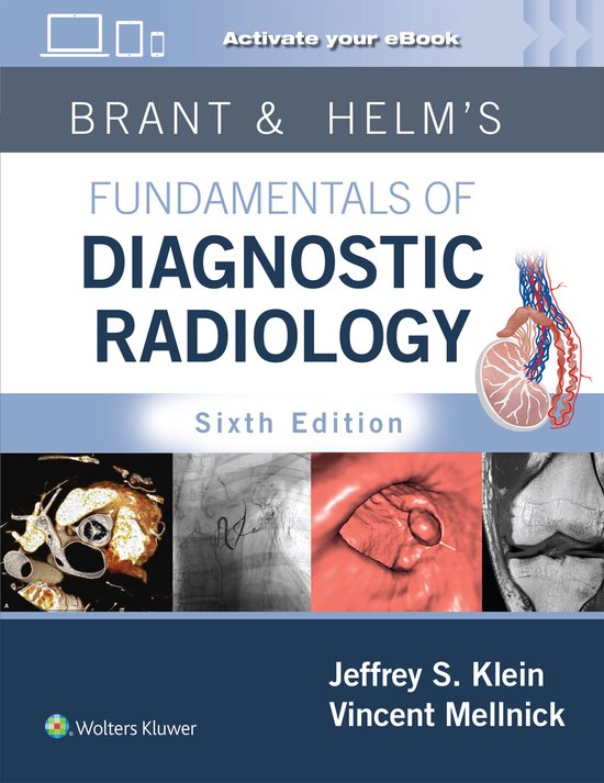 Brant & Helms' Fundamentals of Diagnostic Radiology: Print + ... - cover