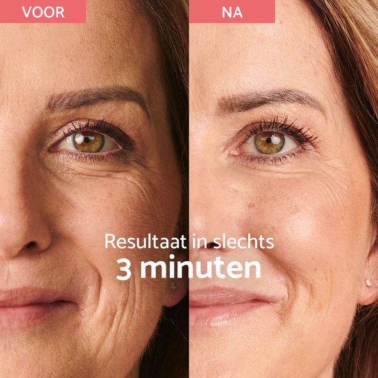 Remescar Instant Rimpel Corrector OUDE VERSIE - Anti Rimpel Crème voor vrouwen en mannen, Anti Aging en Anti Rimpel voor vermindering van rimpels en fijne lijntjes, 8 ml voor 180 applicaties