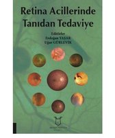 Retina Acillerinde Tanıdan Tedaviye