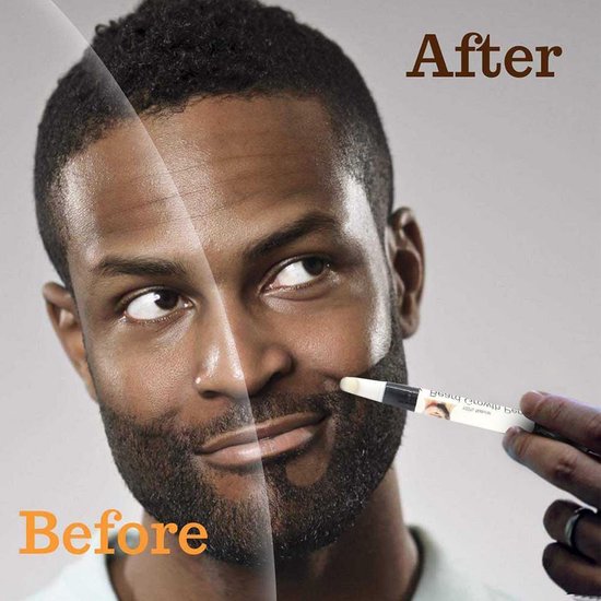 Foto: Baardgroei original stift filler zwart baard pen baard groei baard pen