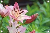 Pink Lily tuinposter los doek 120x80 cm - Tuindoek / Schilderij voor buiten / Tuindecoratie