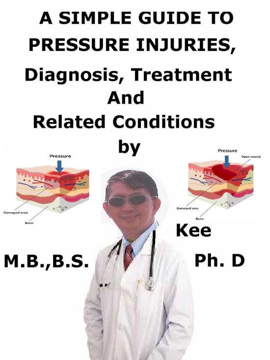 A Simple Guide To Pressure Injuries, Diagnosis, Treatment And Related