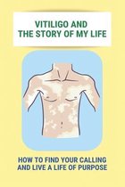 Vitiligo And The Story Of My Life: How To Find Your Calling And Live A Life Of Purpose