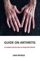 Guide on Arthritis