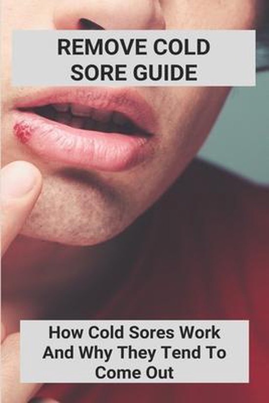 Remove Cold Sore Guide How Cold Sores Work And Why They Tend To Come