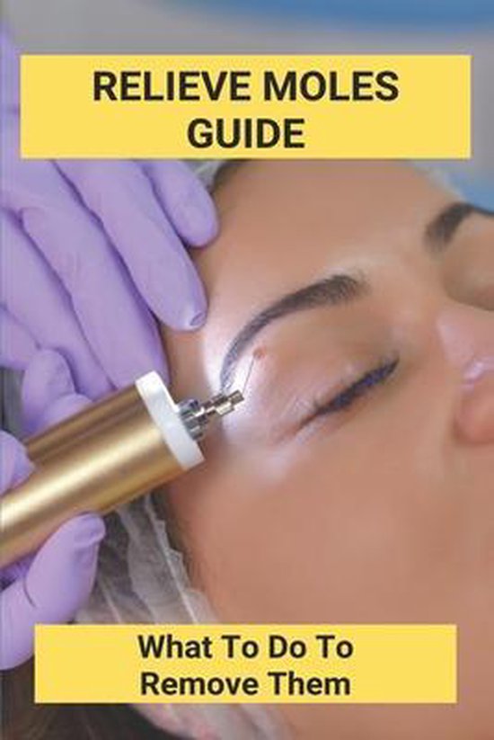 Relieve Moles Guide - cover