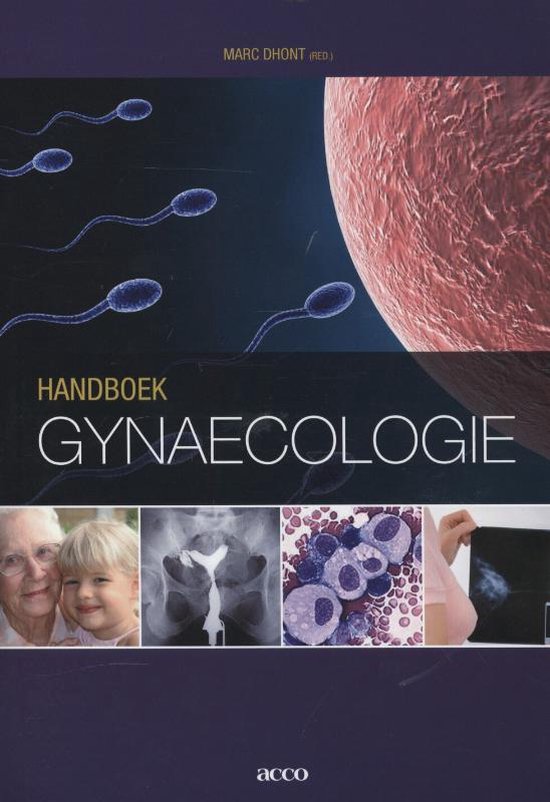 Handboek Gynaecologie - Marc Dhondt | Northernlights300.org