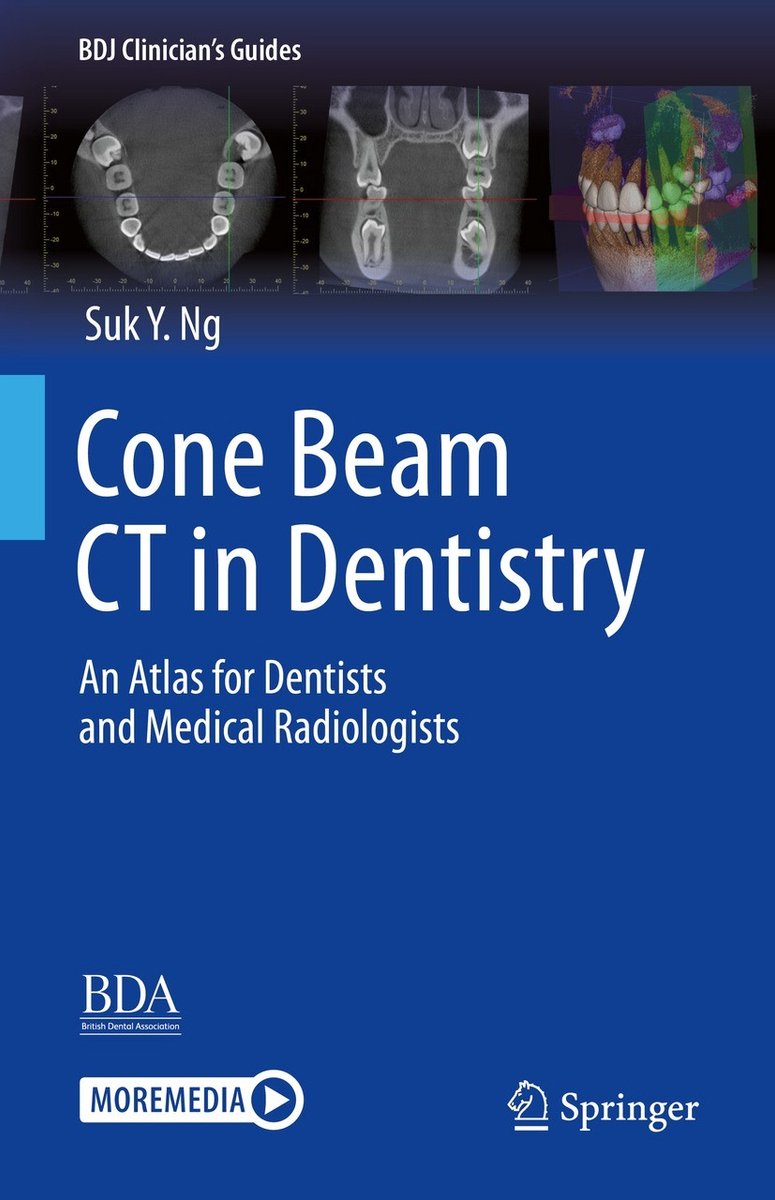Bdj Clinician?s Guides- Cone Beam Ct In Dentistry van Suk Y. Ng