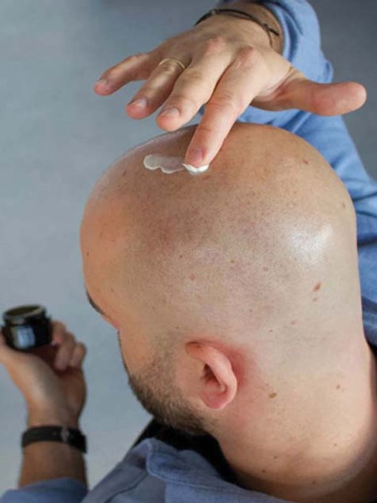Een man met een geschoren hoofd brengt witte crème aan op zijn hoofdhuid met zijn vinger.