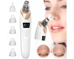 Hoge Kwaliteit Mee-Eter Verwijderen Vacuüm Gezichtsporie Reiniger Elektrische Anti Acne Bestrijden Tool 5 Sondes Voor Vrouwen En Mannen Gezicht Schoonheid