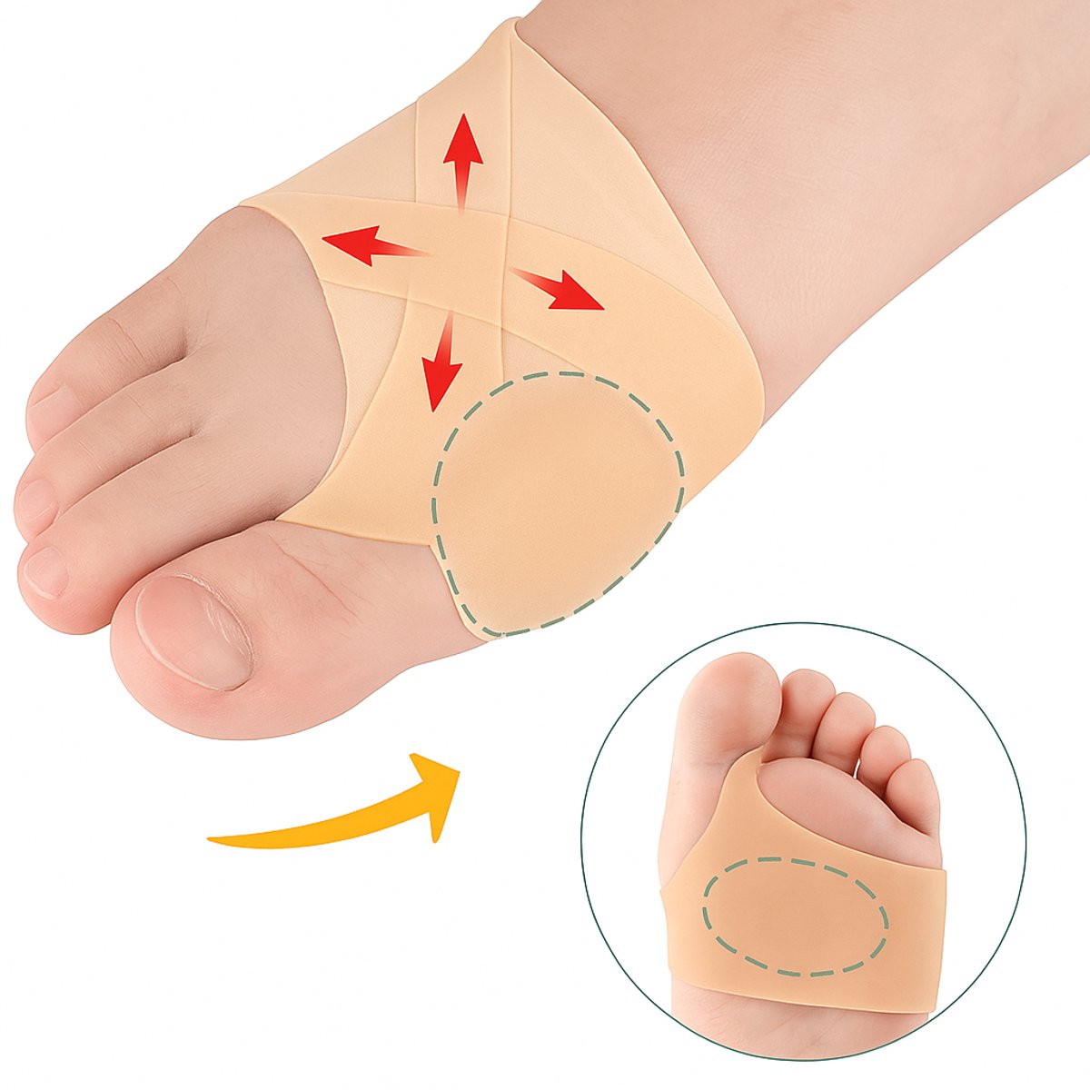 Goedkoopste Hallux Valgus Siliconen Teenbeschermers I Teenspreiders I Teen Corrector I Knobbel I Bunion I Eeltknobbel | Teen Rechtzetten I 1 Paar I Beige