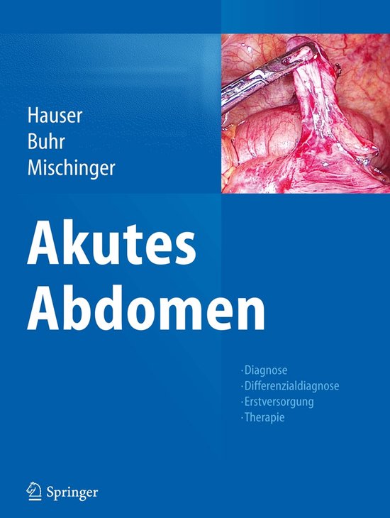 Akutes Abdomen - cover