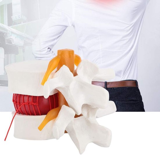 Wanneer heeft vaak plassen een medisch oorzaak Dokternl