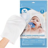 Medcosa Babywashandjes, wegwerp-vochtige doekjes voor pasgeborenen en baby's (12 stuks), gevoelige reinigingsdoekjes voor handen, gezicht en lichaam, verpakking van 1 stuk