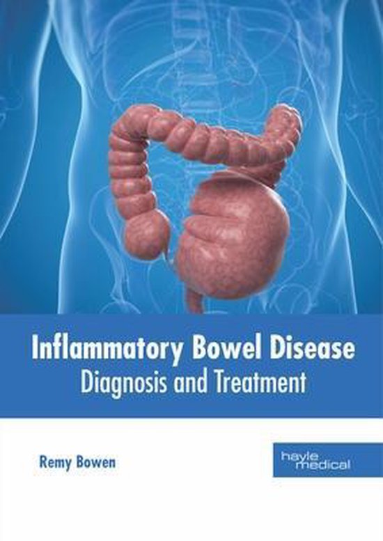 Inflammatory Bowel Disease Diagnosis and Treatment 9781632416148