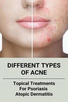 Different Types Of Acne: Topical Treatments For Psoriasis, Atopic Dermatitis