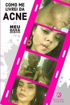 COMO ME LIVREI DA ACNE - Meu guia definitivo
