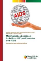 MANIFESTA  ES BUCAIS EM INDIV DUOS HIV P