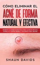 Como Eliminar el Acne de Forma Natural y Efectiva