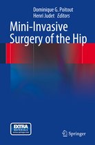 Mini Invasive Surgery of the Hip