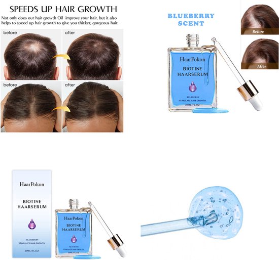 Sérum cheveux | HaarPokon - Stimulateur de Croissance des Cheveux - Contre  la Chute de... | bol.com